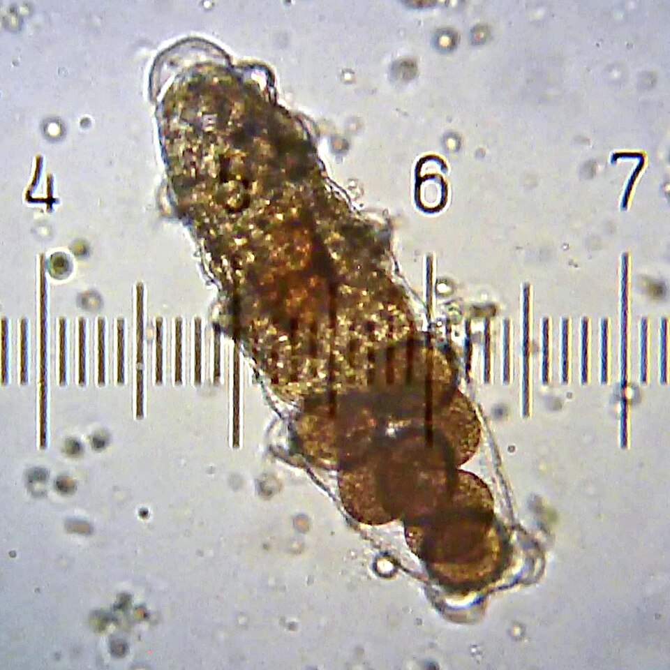 Tardigrades Can Survive Extreme Radiation and Absolute Zero