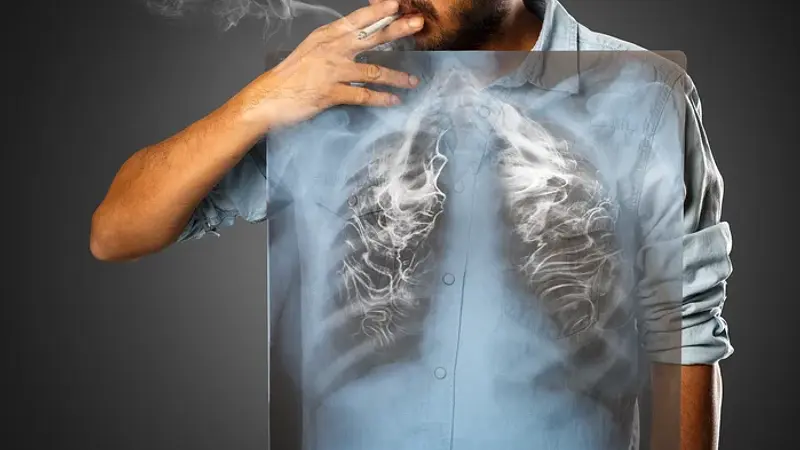 The Cigarette Machine That Created a Global Cancer Epidemic