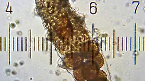 Tardigrades Can Survive Extreme Radiation and Absolute Zero