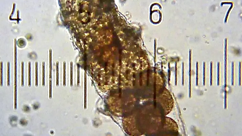 Tardigrades Can Survive Extreme Radiation and Absolute Zero
